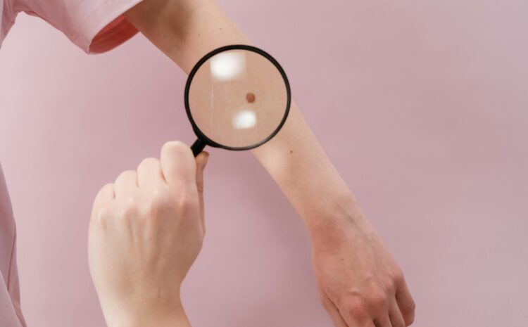  Prevenzione dermatologica all&rsquo;ULSS 8 Berica